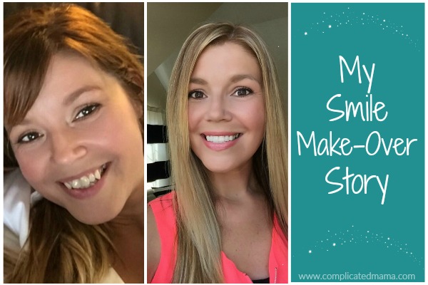 Smile Makeover Story– Before and After